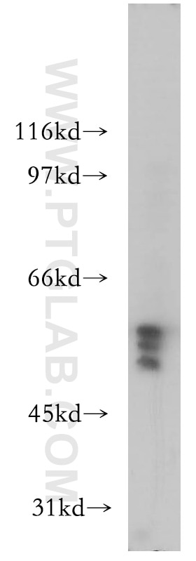 Western Blot (WB) analysis of HeLa cells using S1PR5/EDG8 Polyclonal antibody (13874-1-AP)