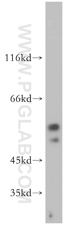 Western Blot (WB) analysis of Jurkat cells using S1PR5/EDG8 Polyclonal antibody (13874-1-AP)