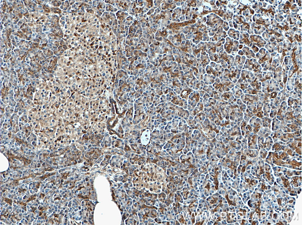 Immunohistochemistry (IHC) staining of human pancreas tissue using PLIN4 Polyclonal antibody (55404-1-AP)