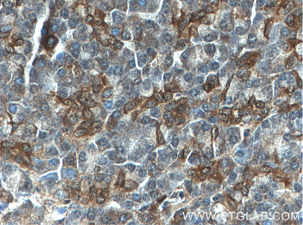 Immunohistochemistry (IHC) staining of human pancreas tissue using PLIN4 Polyclonal antibody (55404-1-AP)