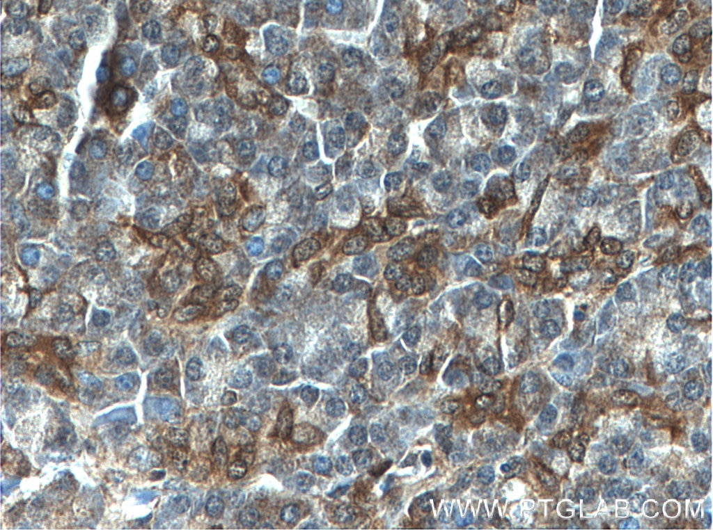 Immunohistochemistry (IHC) staining of human pancreas tissue using PLIN4 Polyclonal antibody (55404-1-AP)