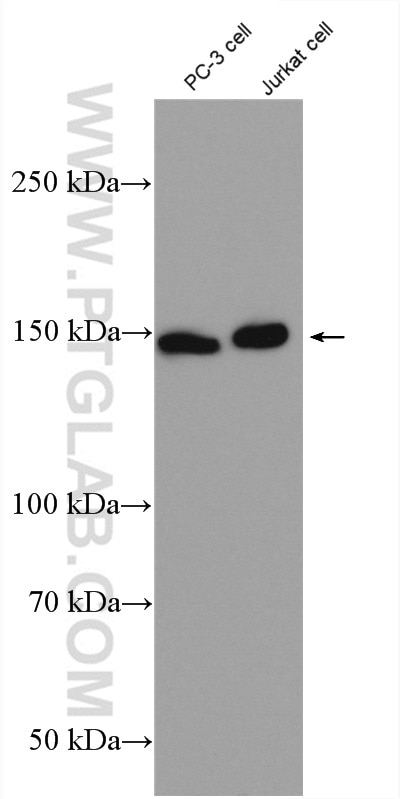 Western Blot (WB) analysis of PC-3 cells using PLIN4 Polyclonal antibody (55404-1-AP)