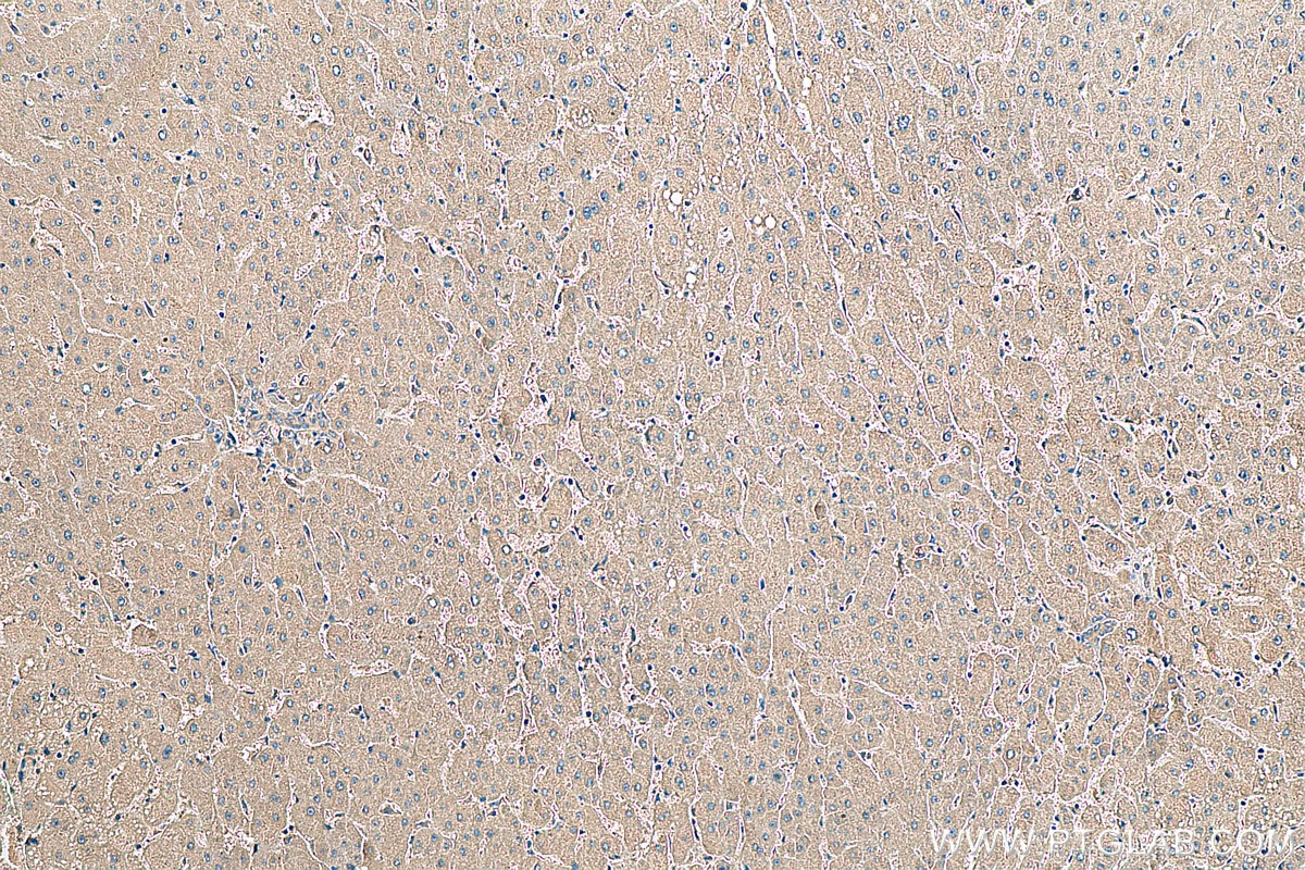 Immunohistochemistry (IHC) staining of human liver tissue using SAA1 Polyclonal antibody (16721-1-AP)