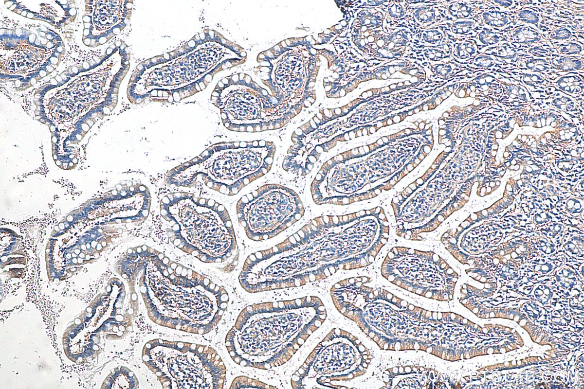 Immunohistochemistry (IHC) staining of human small intestine tissue using SAA1 Polyclonal antibody (16721-1-AP)