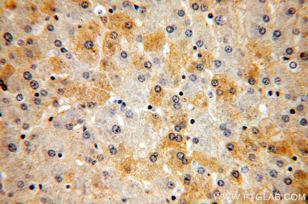 SAA1 Polyclonal antibody