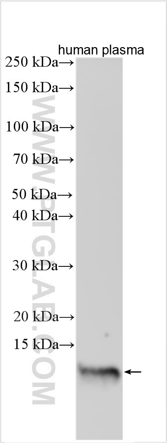 Western Blot (WB) analysis of various lysates using SAA1 Polyclonal antibody (16721-1-AP)