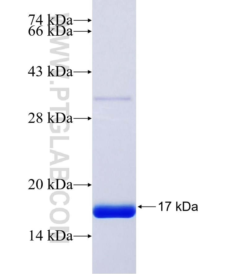 SAA1 fusion protein Ag23459 SDS-PAGE