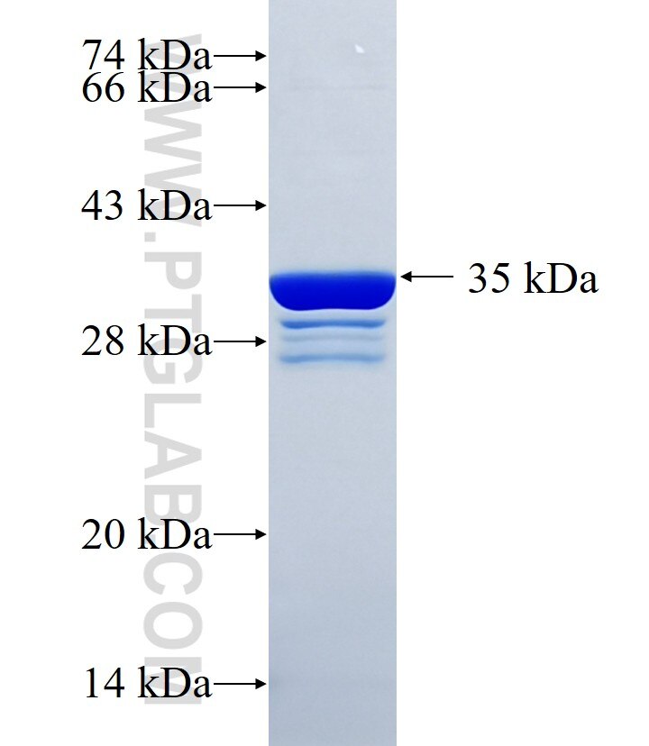 SAA1 fusion protein Ag10160 SDS-PAGE