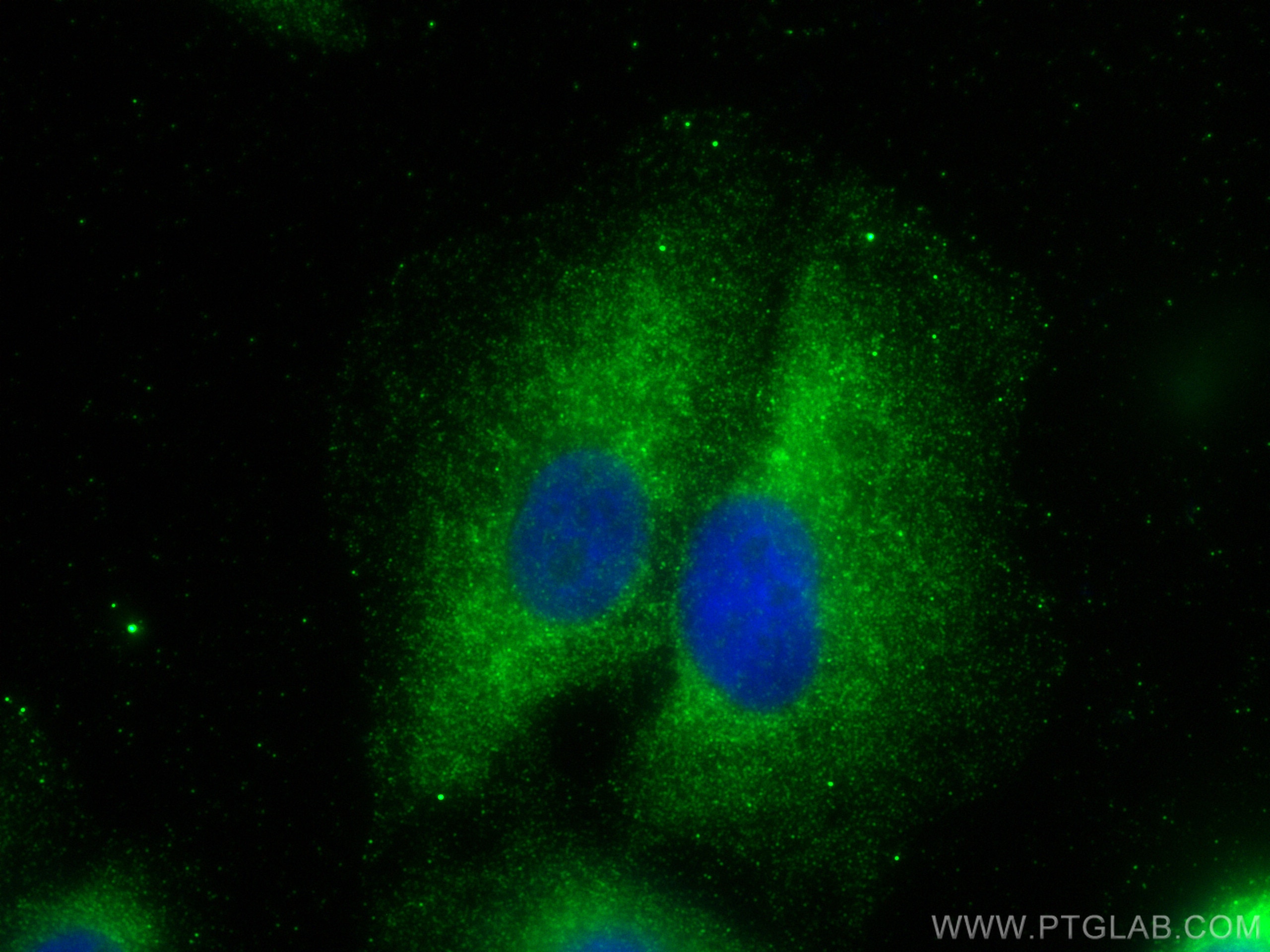 Immunofluorescence (IF) / fluorescent staining of A549 cells using SAA2 Polyclonal antibody (13192-1-AP)