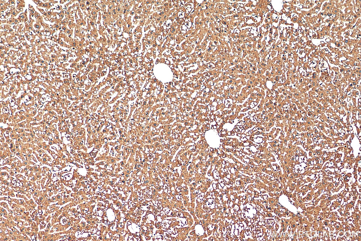 IHC staining of mouse liver using 13192-1-AP