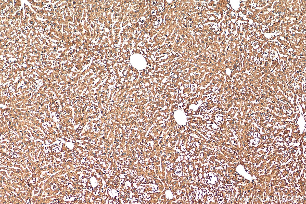 Immunohistochemistry (IHC) staining of mouse liver tissue using SAA2 Polyclonal antibody (13192-1-AP)