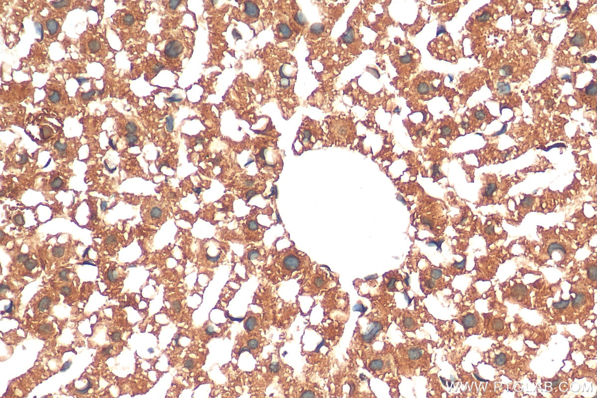 Immunohistochemistry (IHC) staining of mouse liver tissue using SAA2 Polyclonal antibody (13192-1-AP)