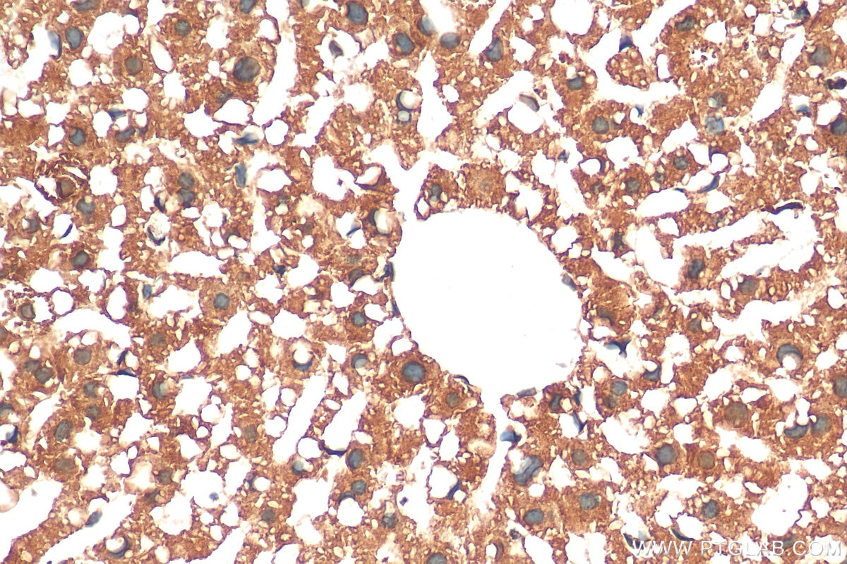 IHC staining of mouse liver using 13192-1-AP