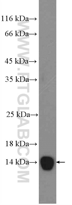 Western Blot (WB) analysis of serum from mouse injected with bacteria using SAA2 Polyclonal antibody (13192-1-AP)