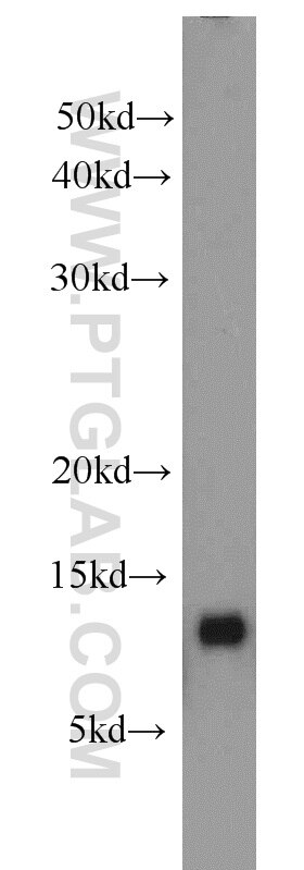 SAA2 Polyclonal antibody