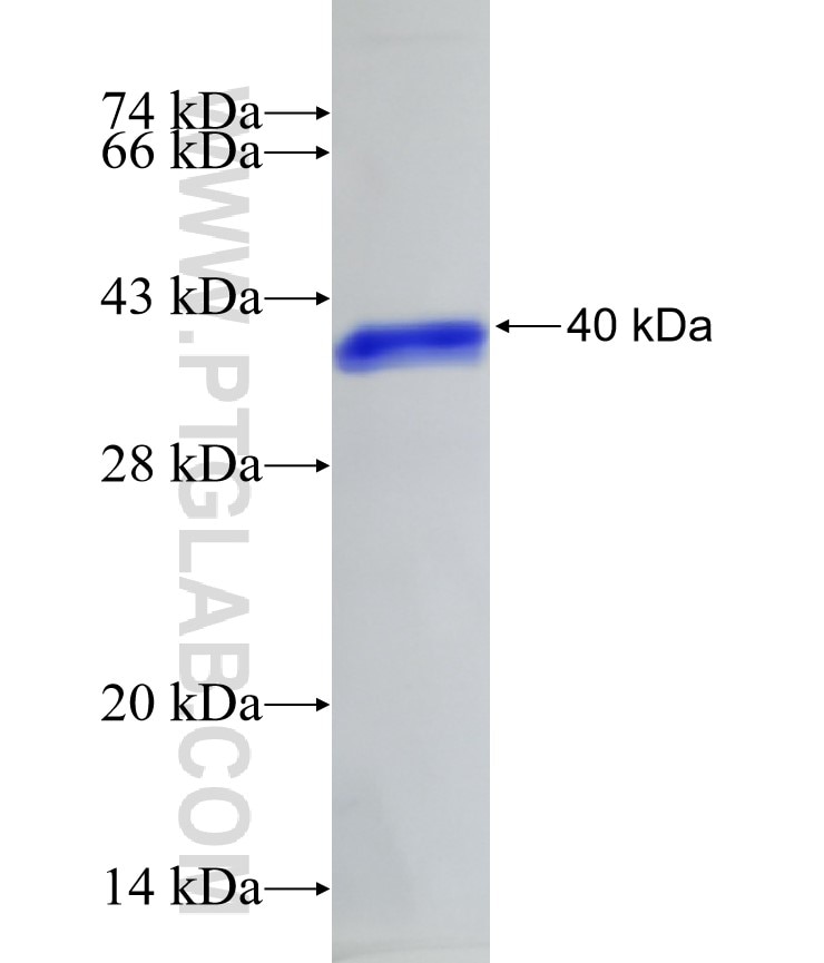 SAA2 fusion protein Ag3869 SDS-PAGE