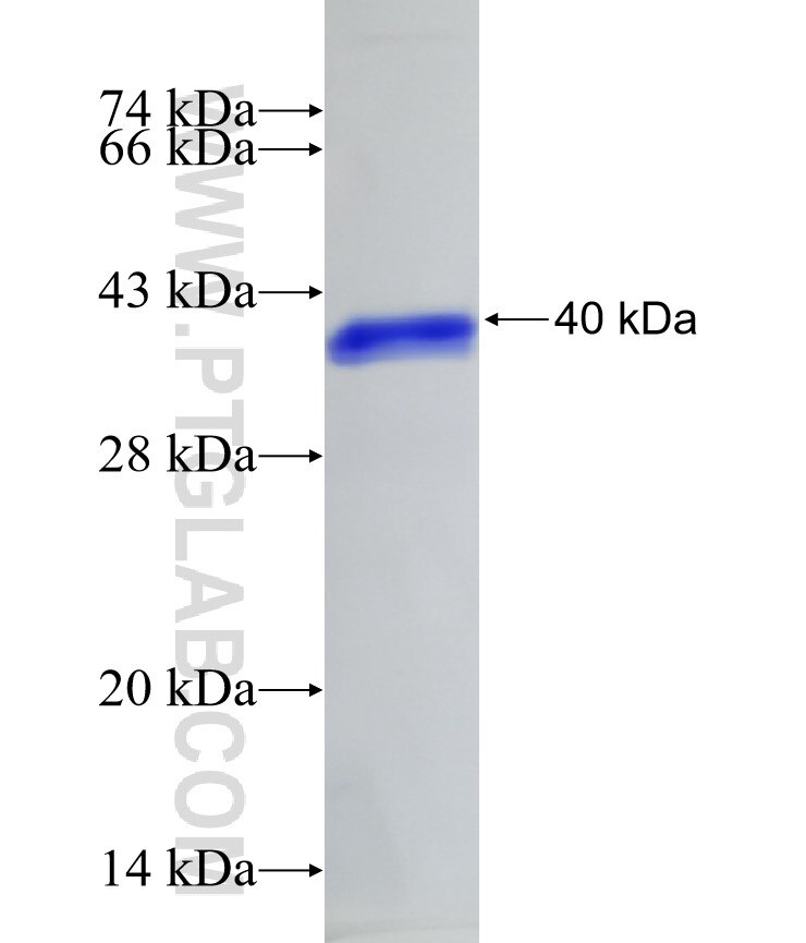 SAA2 fusion protein Ag3869 SDS-PAGE