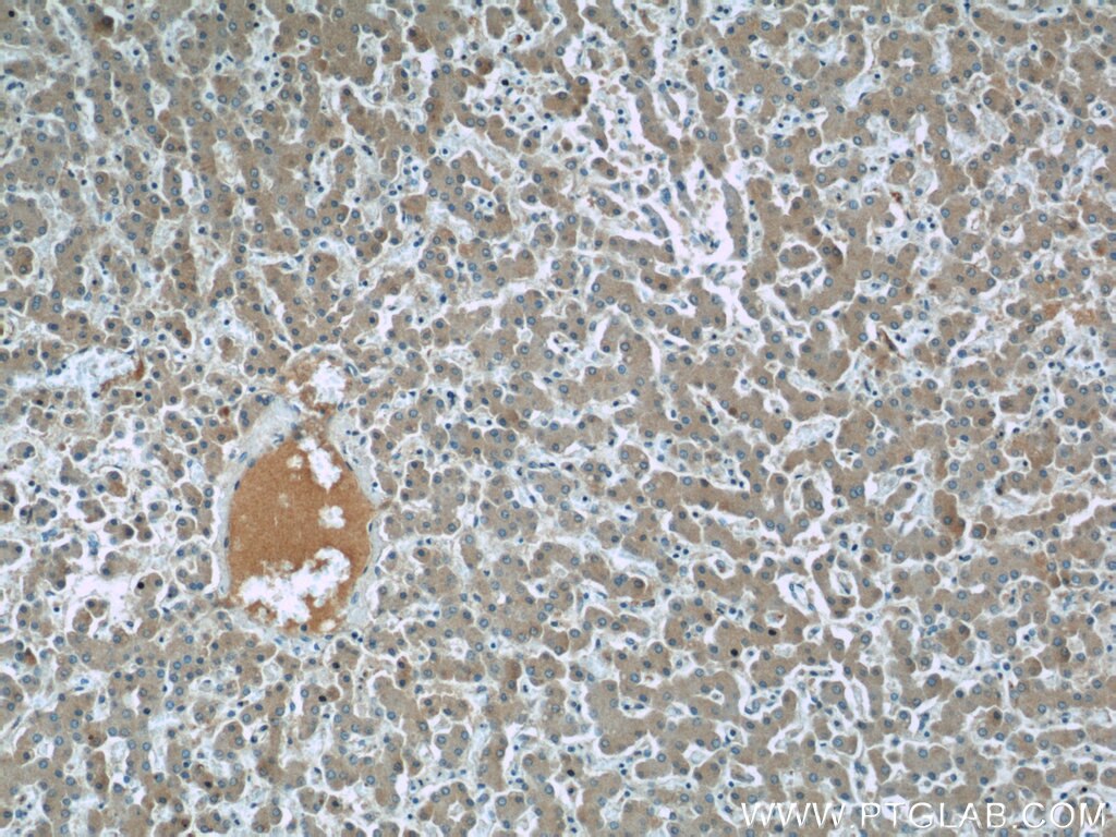 Immunohistochemistry (IHC) staining of human liver tissue using SAA4 Polyclonal antibody (20398-1-AP)