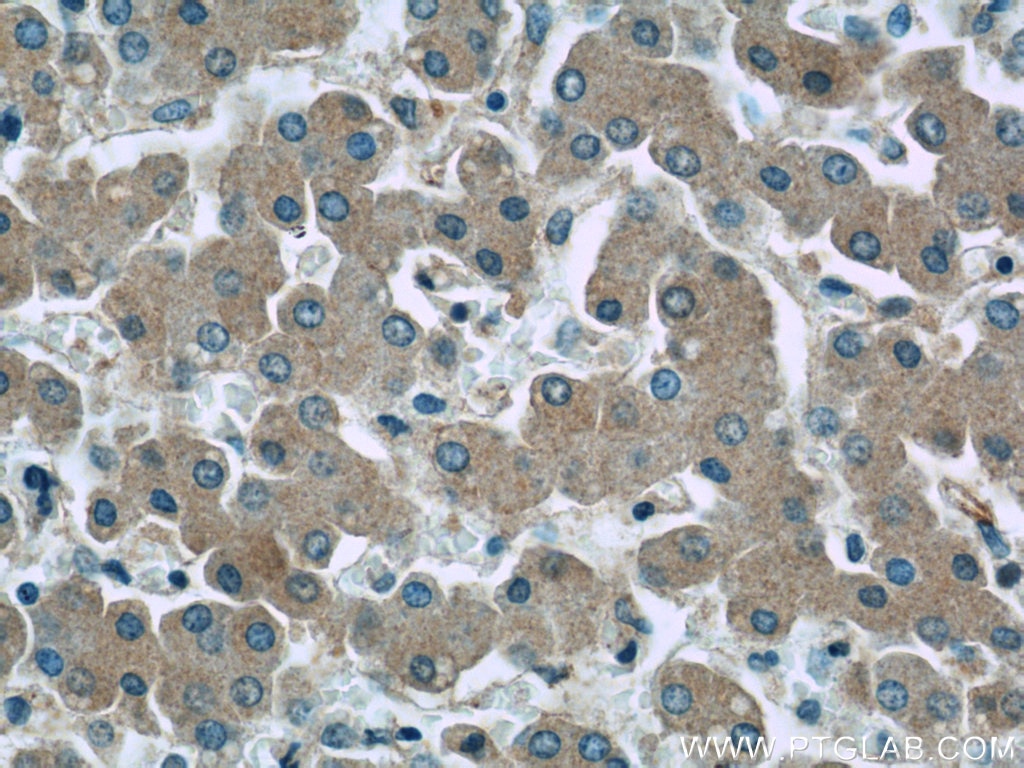 Immunohistochemistry (IHC) staining of human liver tissue using SAA4 Polyclonal antibody (20398-1-AP)