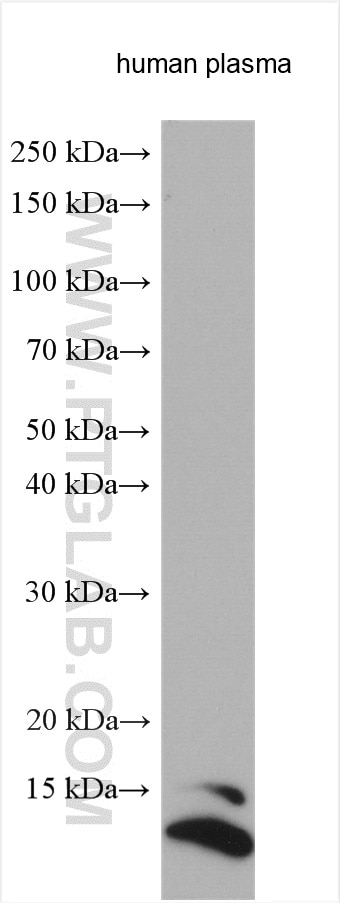 Western Blot (WB) analysis of various lysates using SAA4 Polyclonal antibody (20398-1-AP)