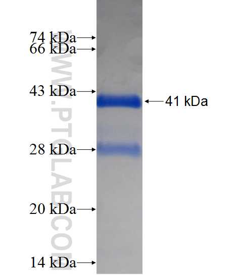 SAA4 fusion protein Ag14081 SDS-PAGE