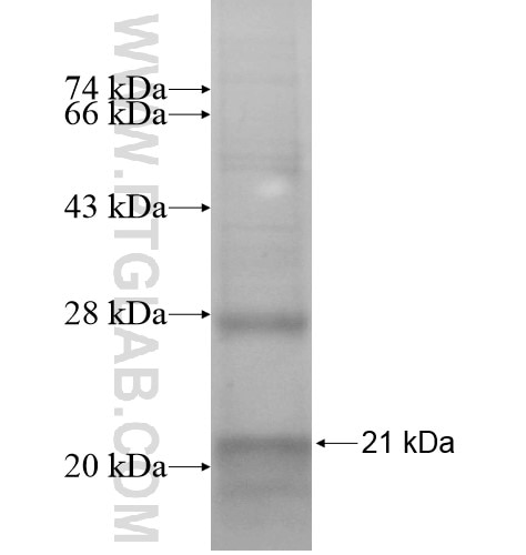 SAA4 fusion protein Ag15096 SDS-PAGE