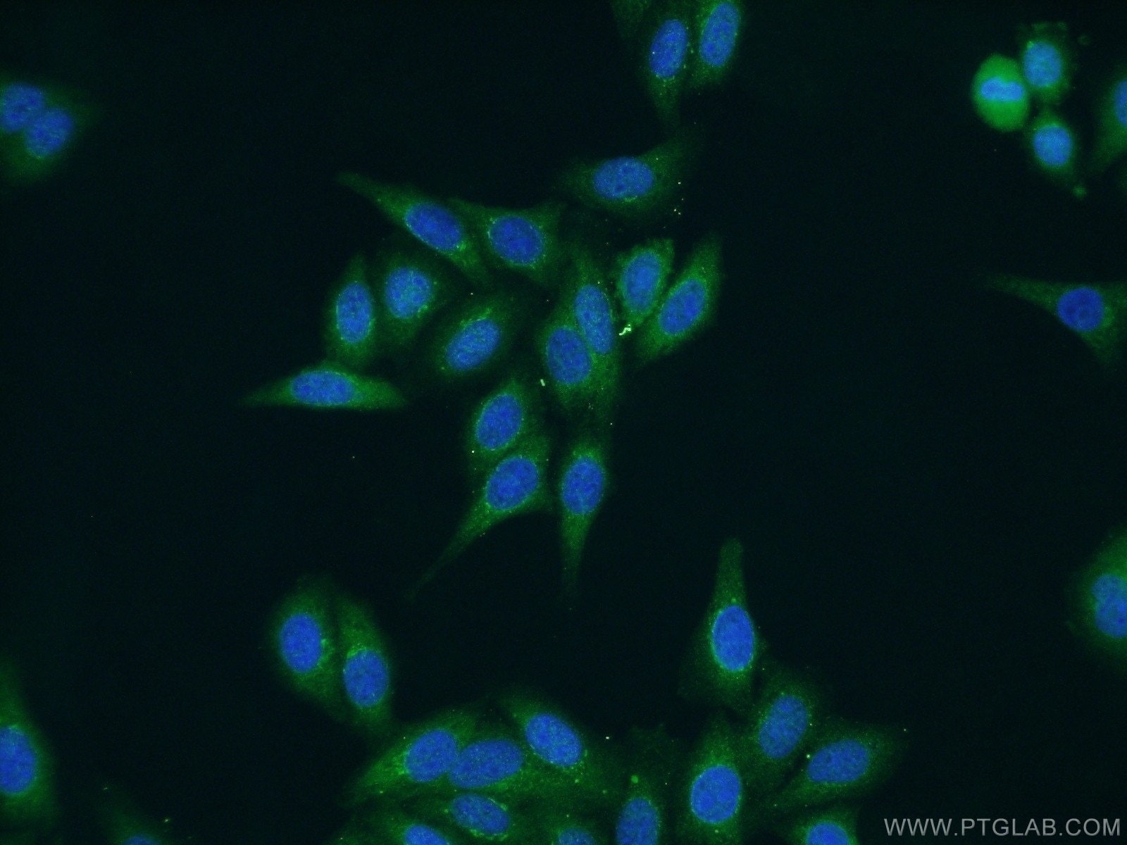 Immunofluorescence (IF) / fluorescent staining of HepG2 cells using SAAL1 Polyclonal antibody (25467-1-AP)