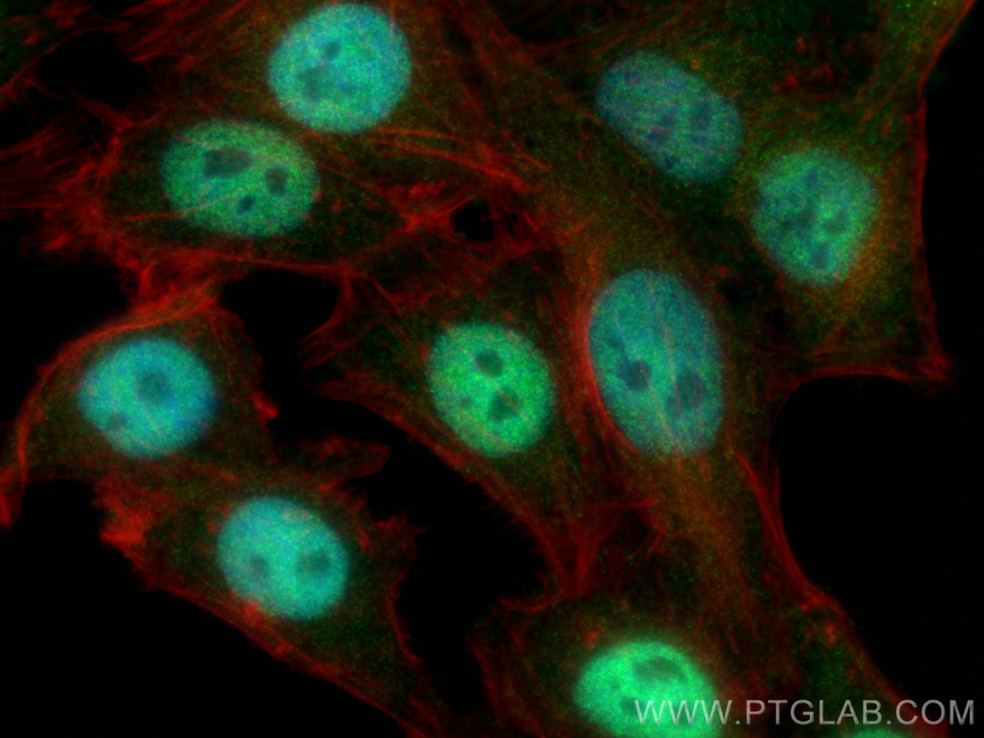 Immunofluorescence (IF) / fluorescent staining of HepG2 cells using SAAL1 Polyclonal antibody (25467-1-AP)