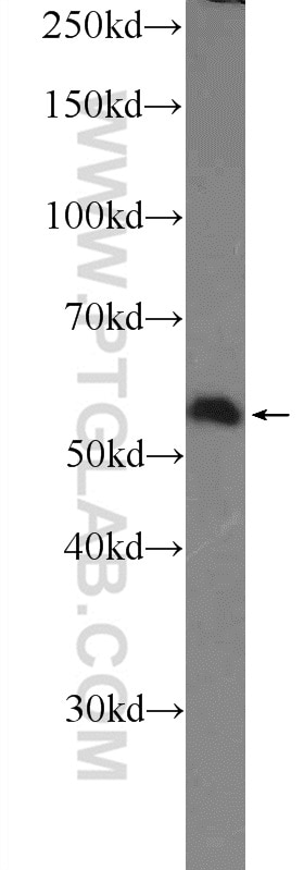 Western Blot (WB) analysis of HEK-293 cells using SAAL1 Polyclonal antibody (25467-1-AP)