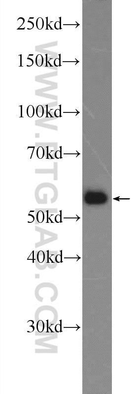 Western Blot (WB) analysis of HepG2 cells using SAAL1 Polyclonal antibody (25467-1-AP)