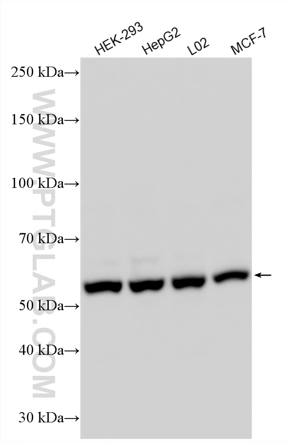 Various lysates were subjected to SDS PAGE followed by western blot with 25467-1-AP (SAAL1 antibody) at dilution of 1:2000 incubated at room temperature for 1.5 hours. Western Blot (WB) analysis of various lysates using SAAL1 Polyclonal antibody (25467-1-AP)