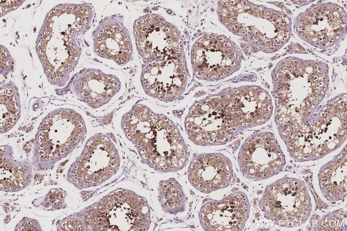 Immunohistochemistry (IHC) staining of human testis tissue using SAC3D1 Polyclonal antibody (25857-1-AP)