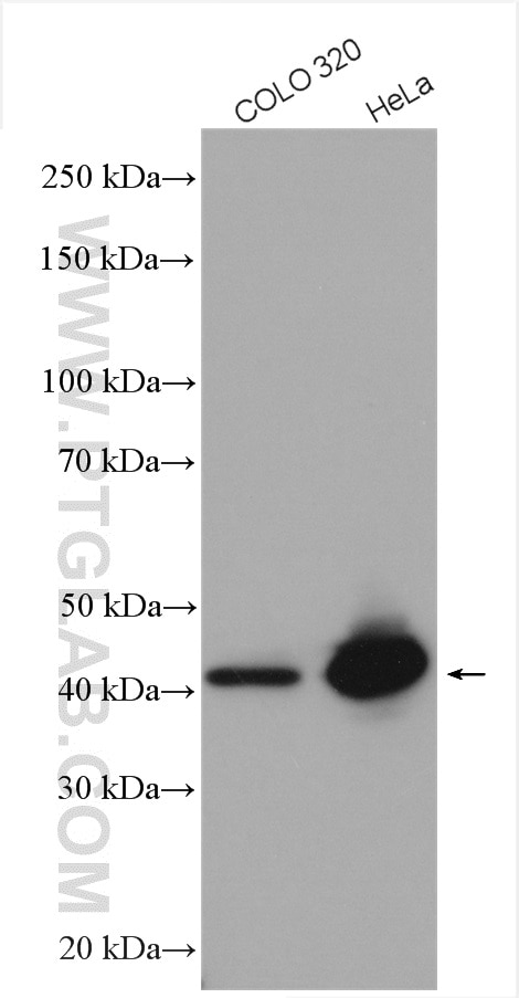 Western Blot (WB) analysis of various lysates using SAC3D1 Polyclonal antibody (25857-1-AP)