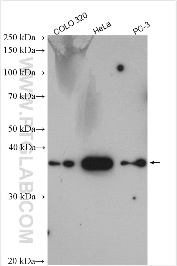 Western Blot (WB) analysis of various lysates using SAC3D1 Polyclonal antibody (25857-1-AP)
