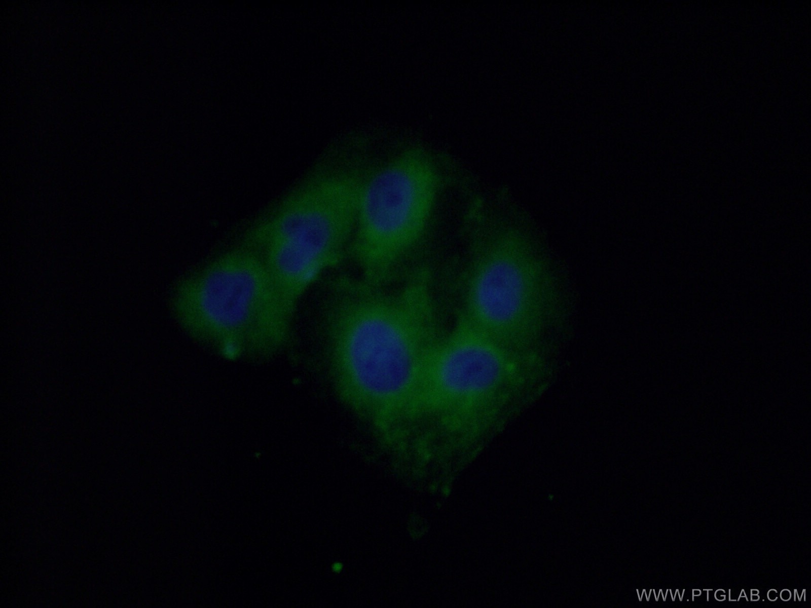 Immunofluorescence (IF) / fluorescent staining of A549 cells using SACM1L Polyclonal antibody (13033-1-AP)