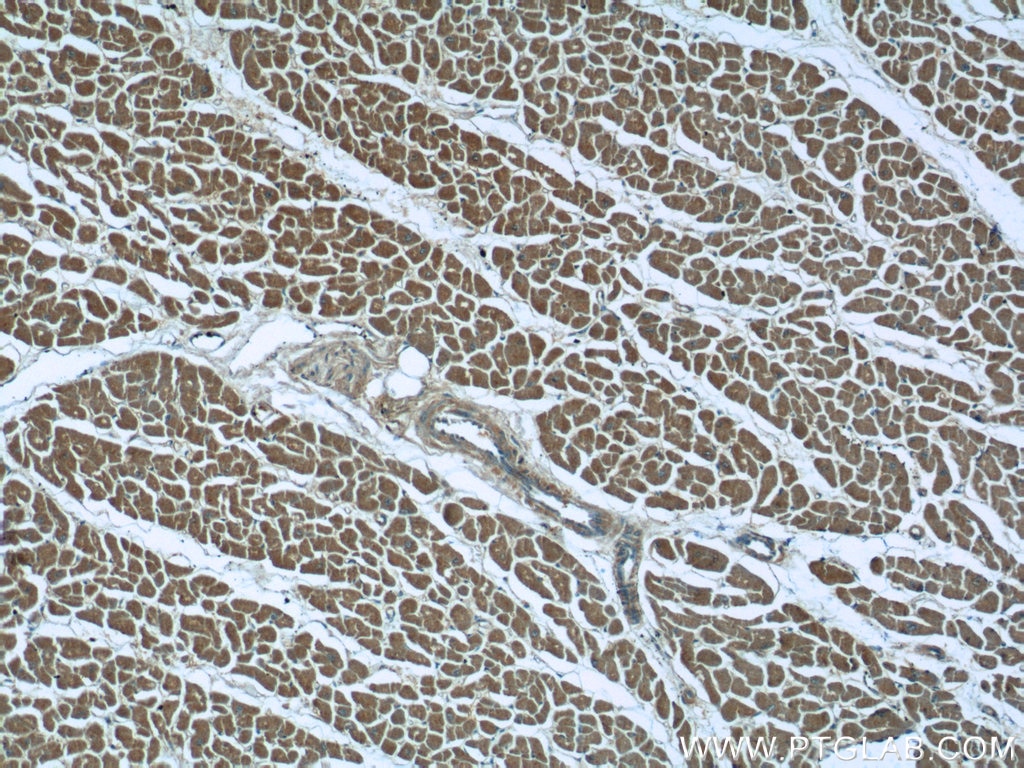 IHC staining of human heart using 13033-1-AP