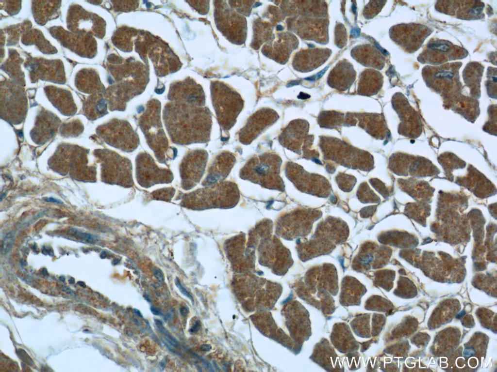 Immunohistochemistry (IHC) staining of human heart tissue using SACM1L Polyclonal antibody (13033-1-AP)