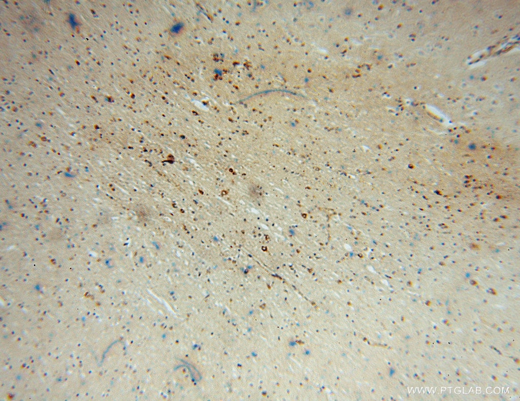 Immunohistochemistry (IHC) staining of human brain tissue using SACM1L Polyclonal antibody (13033-1-AP)