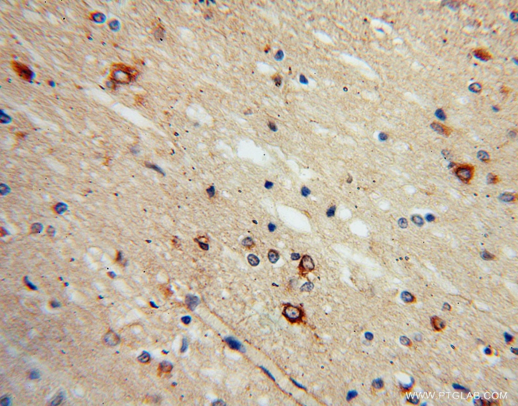Immunohistochemistry (IHC) staining of human brain tissue using SACM1L Polyclonal antibody (13033-1-AP)