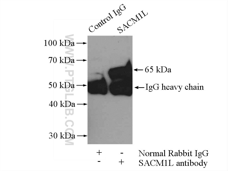 Immunoprecipitation (IP) experiment of mouse kidney tissue using SACM1L Polyclonal antibody (13033-1-AP)
