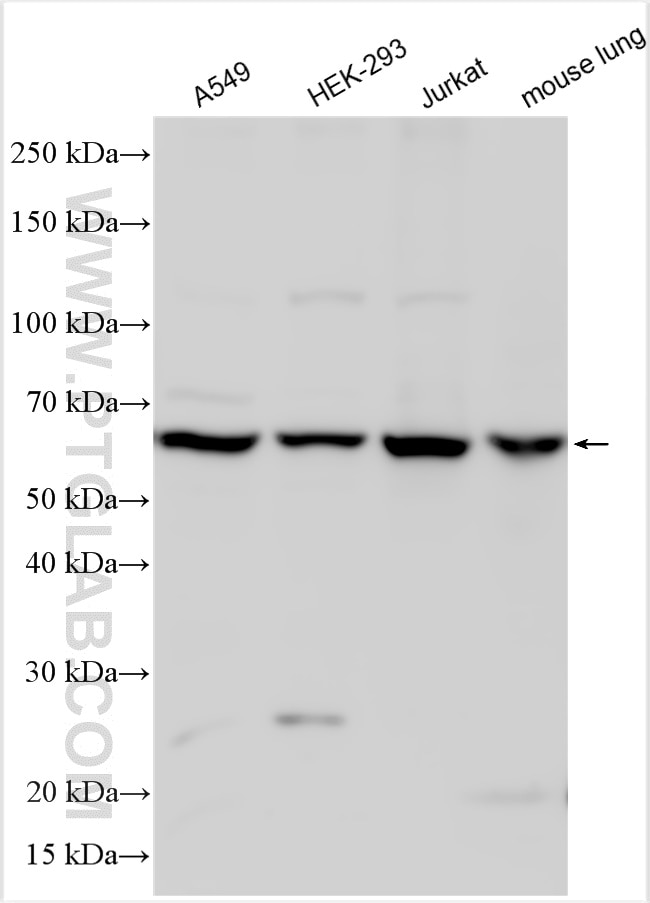 Western Blot (WB) analysis of various lysates using SACM1L Polyclonal antibody (13033-1-AP)