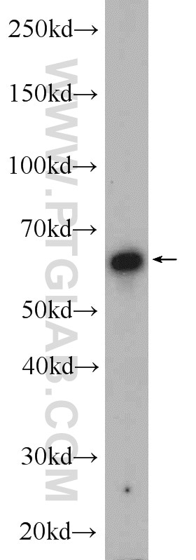 Western Blot (WB) analysis of mouse kidney tissue using SACM1L Polyclonal antibody (13033-1-AP)