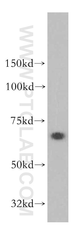 Western Blot (WB) analysis of human kidney tissue using SACM1L Polyclonal antibody (13033-1-AP)
