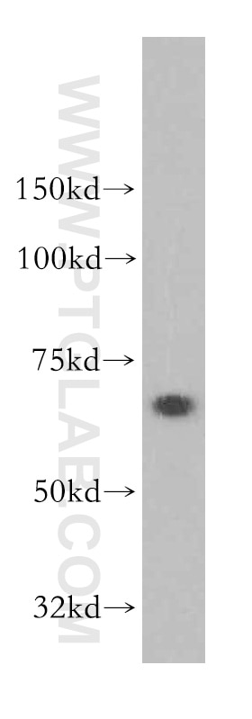 WB analysis of human kidney using 13033-1-AP