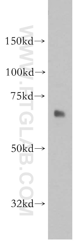 Western Blot (WB) analysis of mouse lung tissue using SACM1L Polyclonal antibody (13033-1-AP)