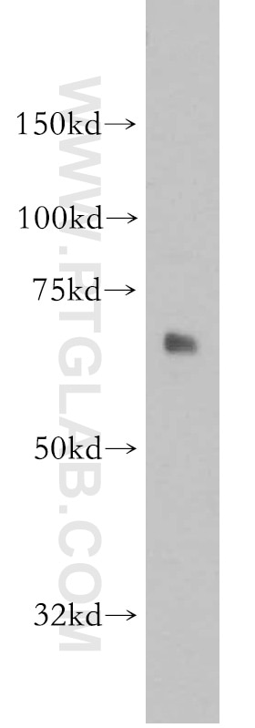 WB analysis of mouse lung using 13033-1-AP