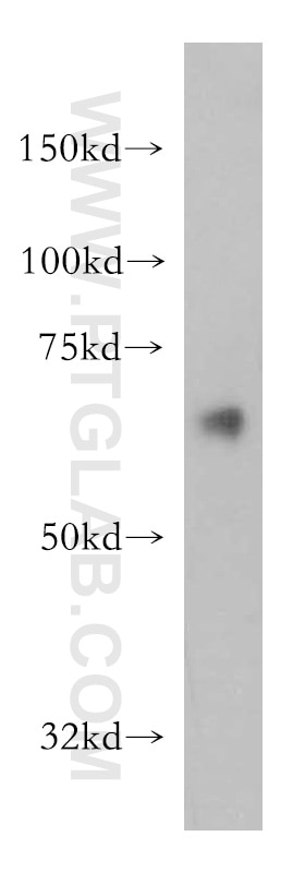 Western Blot (WB) analysis of human brain tissue using SACM1L Polyclonal antibody (13033-1-AP)