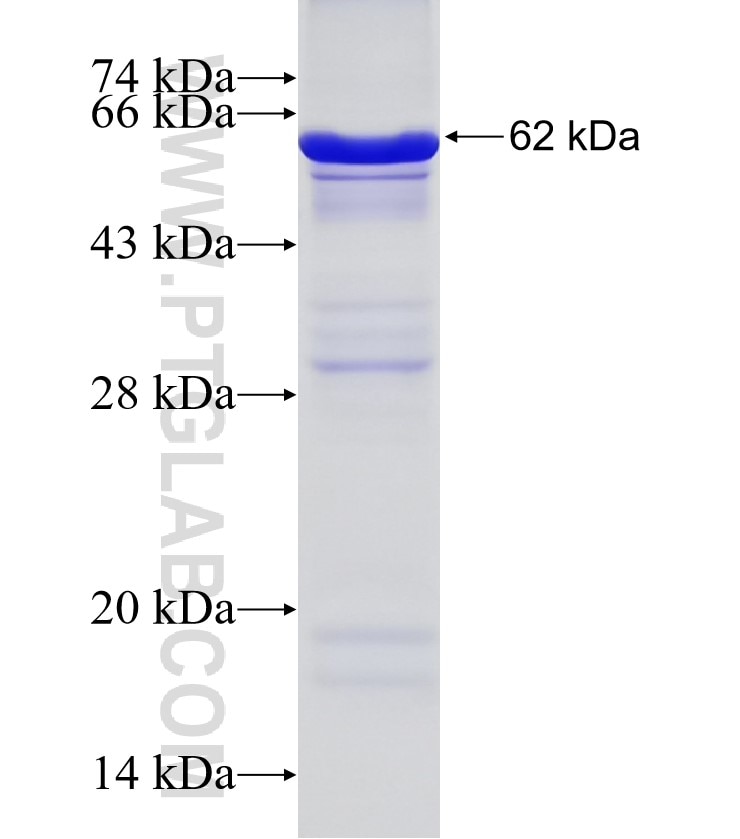 SACM1L fusion protein Ag3682 SDS-PAGE