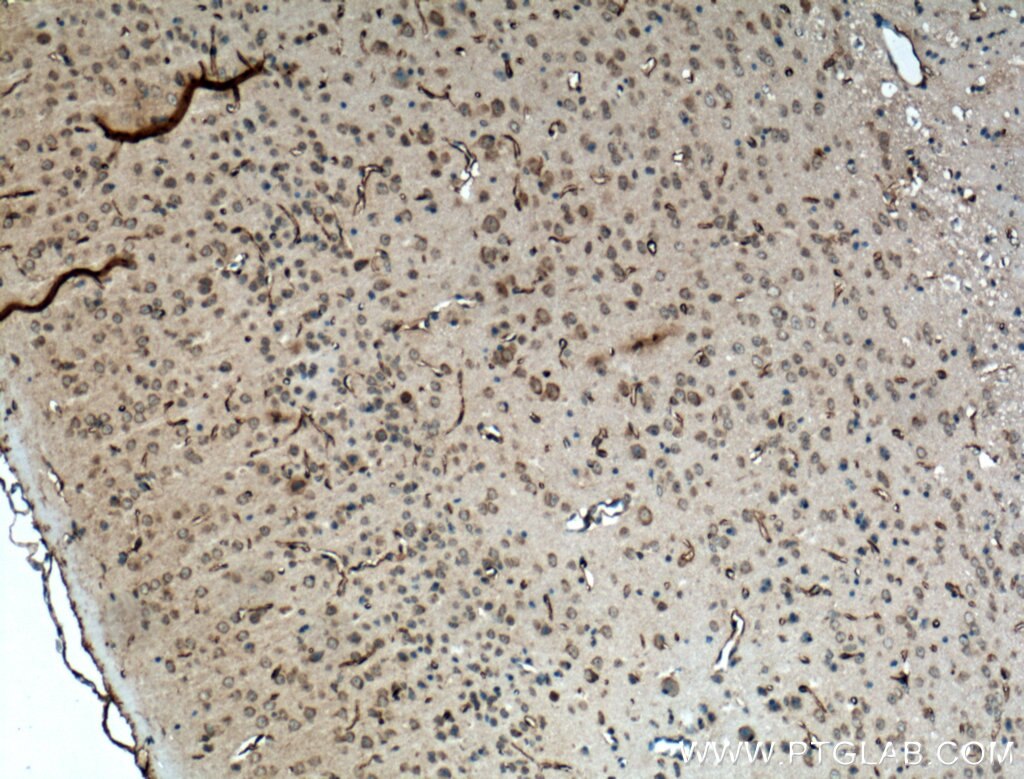 Immunohistochemistry (IHC) staining of mouse brain tissue using SACS Polyclonal antibody (22265-1-AP)