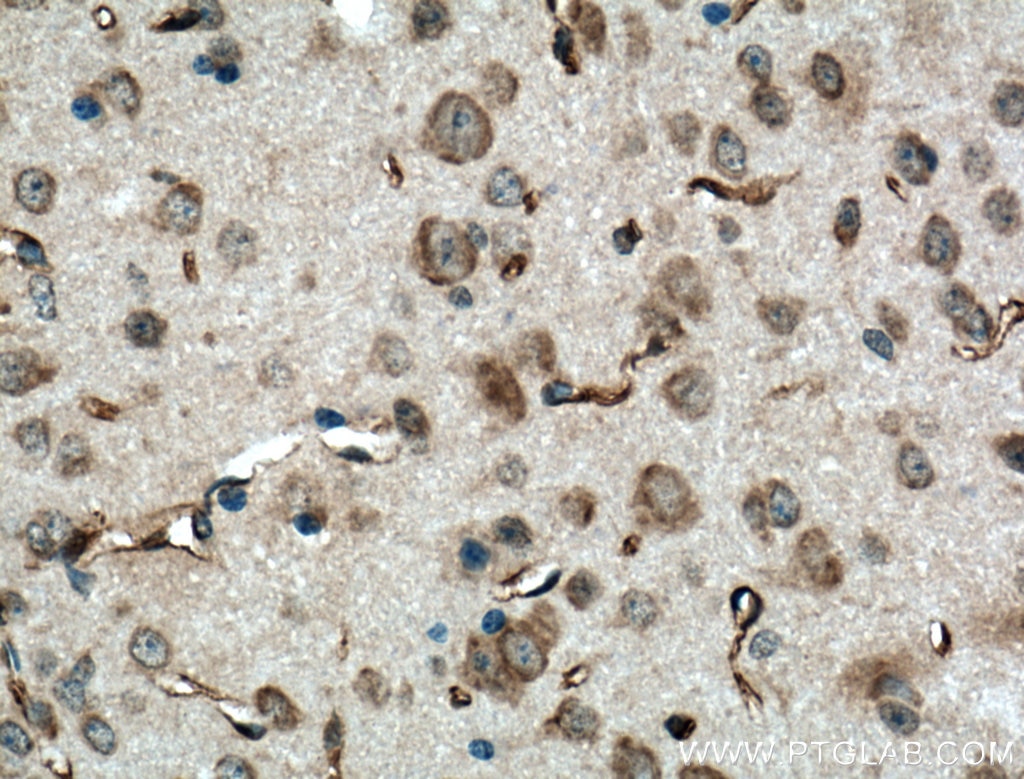 Immunohistochemistry (IHC) staining of mouse brain tissue using SACS Polyclonal antibody (22265-1-AP)